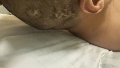 4名游客景区内遭马蜂袭击,旅游度假区:是森林公园不卖门票,蜇伤先就医后提供证据投诉