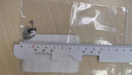 700°C!浙江男子瞬间失明!紧急提醒