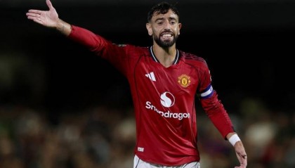 B费谈德比:曼城用四名中场对抗我们两名中场 要像踢枪手那样压迫