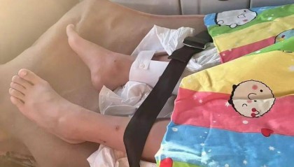 男子火车上铺跌落砸断10岁女孩腿骨，回应“失联”称失业讨薪中