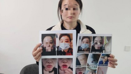 郑州一女子被企业家丈夫家暴最新进展:已要回孩子抚养权