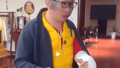 周黑鸭创始人突遇爆炸!脸部和手臂被炸伤,本人呼吁:大家一定要买正规牌子