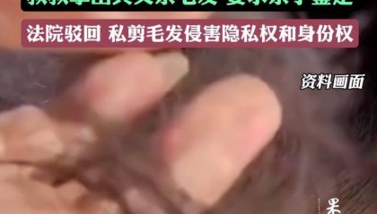 父母离婚2年后父亲意外去世,25岁男子继承父亲遗产,叔叔阻拦并拿出其父亲毛发要求亲子鉴定